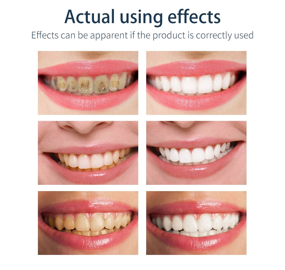 Tooth-Cleaning Mousse Toothpaste