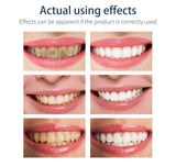 Tooth-Cleaning Mousse Toothpaste