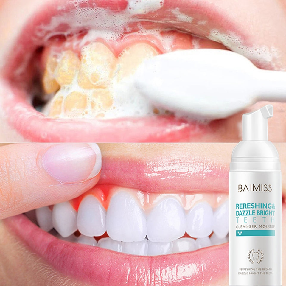 Tooth-Cleaning Mousse Toothpaste